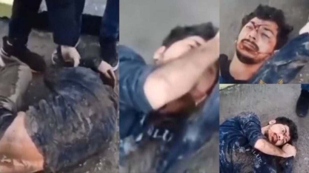 Diyar Koç dün gece tutuklandı. Bayrak indirmeye dair tek bir sorunun yer almadığı bu aşamada  neler yaşadı: 

*Sınırdan sonra emniyette de darpa maruz bırakıldı 

*Onu ilk gören avukatlar: konuşamıyordu, kuru kan kokuyordu 

*Hastaneden tehditlerle taburcu edildi 

*Adliyeye ve