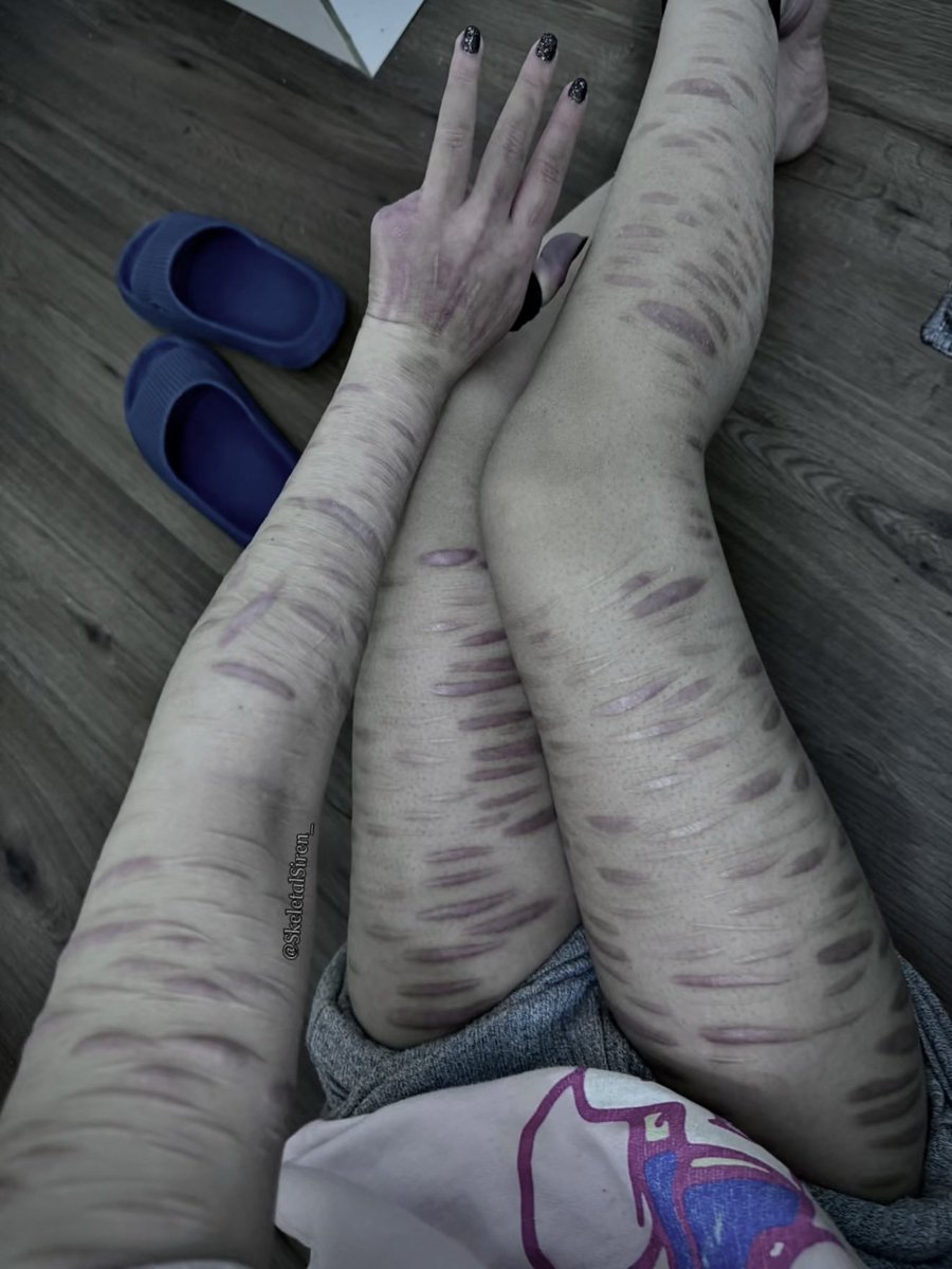 SkeletalSiren_'s tweet image. haven’t cut in over a year