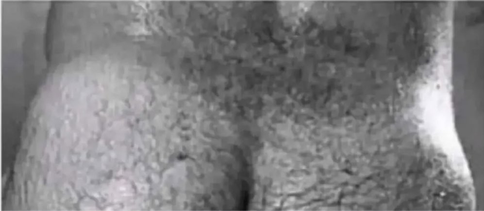 "i don't like women with stretch marks" 
and you think women like men like this too?😒