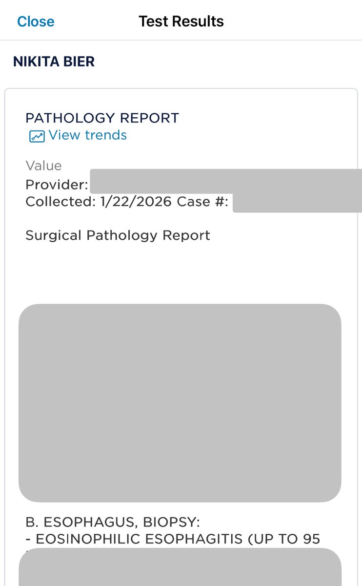 Nikita Bier tweet media