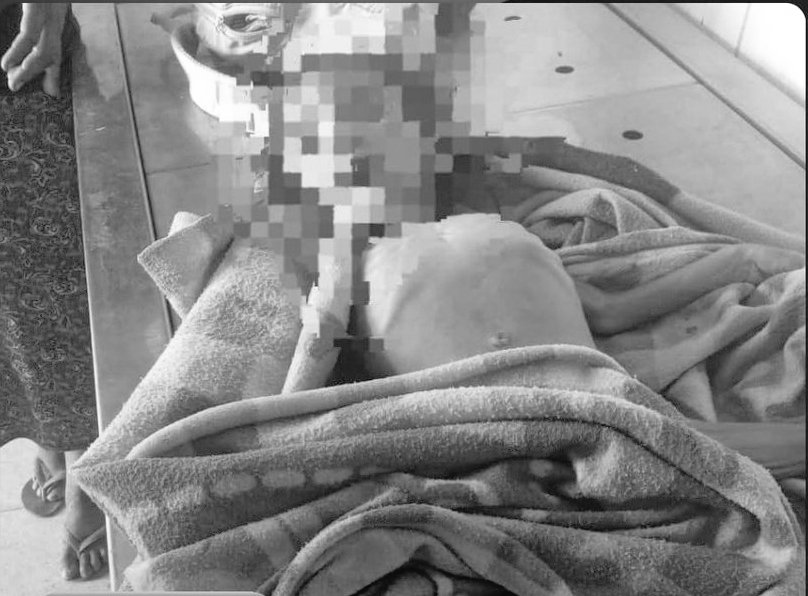 🔴NIÑA DE 3 AÑOS MUERE DE HAMBRE EN AMAMBAY: FAMILIA COMÍA SOLO UNA VEZ AL DÍA 

◾La perito indígena de la Corte Suprema de Justicia en Amambay, Digna Morilla, expuso las pésimas condiciones en las que vivía la familia de la niña. "Ella murió de hambre", expresó. En su relato,