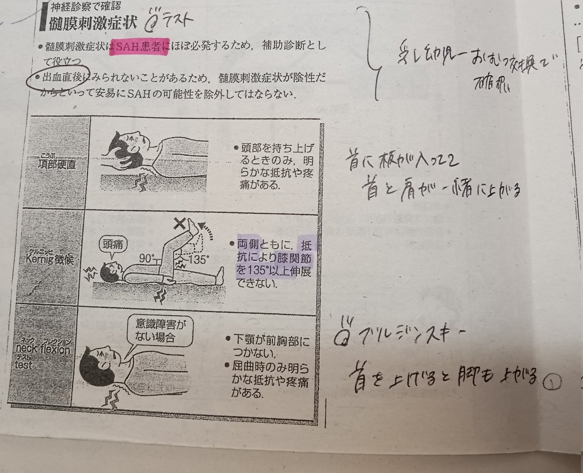 Papi_Hydrangea_'s tweet image. くも膜下出血まとめ