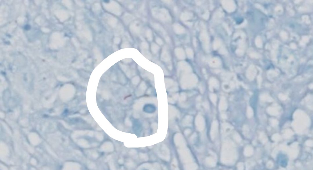 aung phyo tweet media