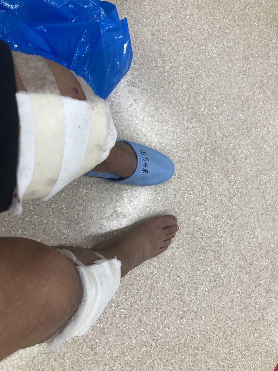 sokabokumetsu's tweet image. 反創価学会の活動をしていてバイクを乗っている際に信者達に複数の車で追いかけまわされたことがある
交差点を一時停止して侵入右から来た車に撥ねられ病院へ
柏市の畑の中明らかに目撃者はいなかったのに4人から一時停止してないといわれた
事故相手の家に訪問すると公明党ポスター
1番身の危険感じた