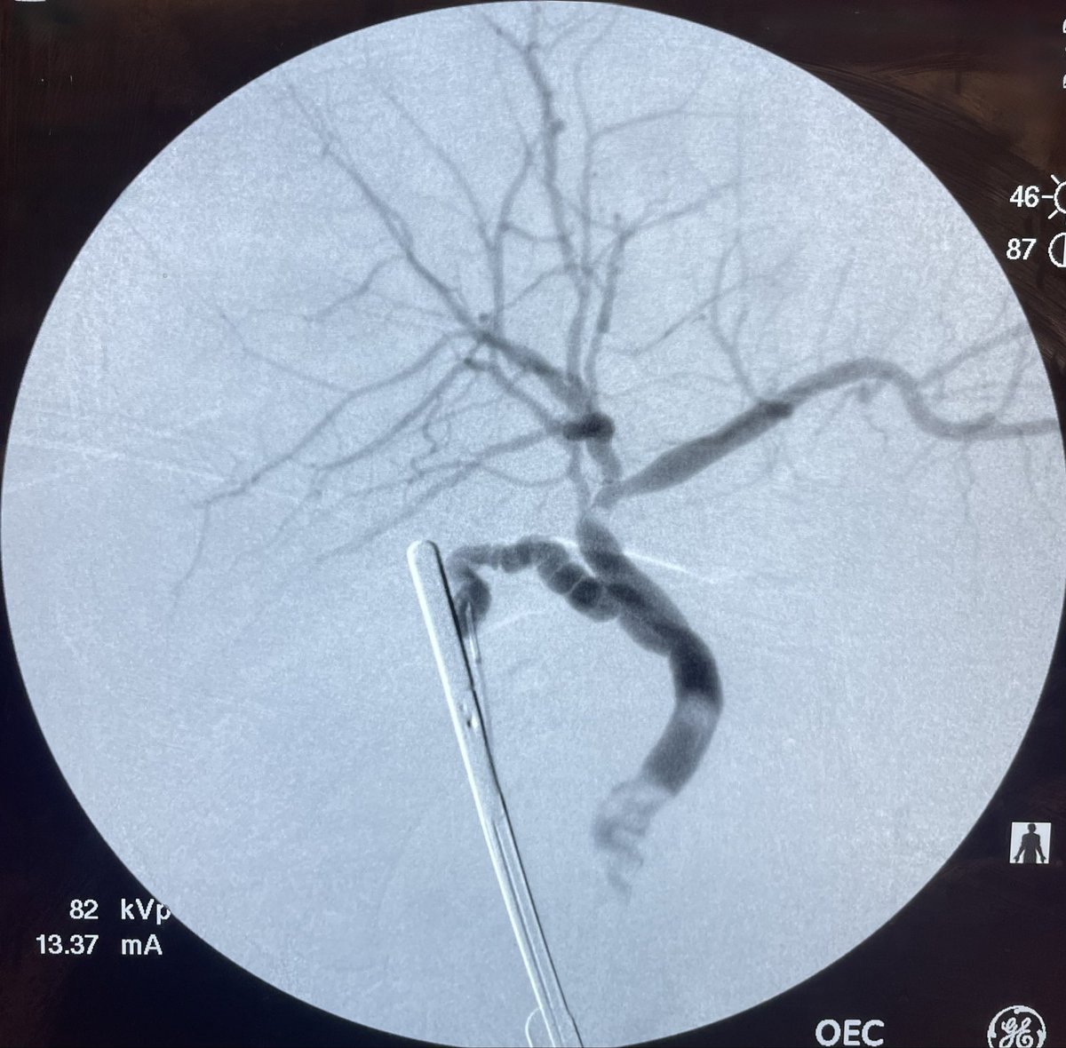 S. Arshia Arshad, MD, MS tweet media