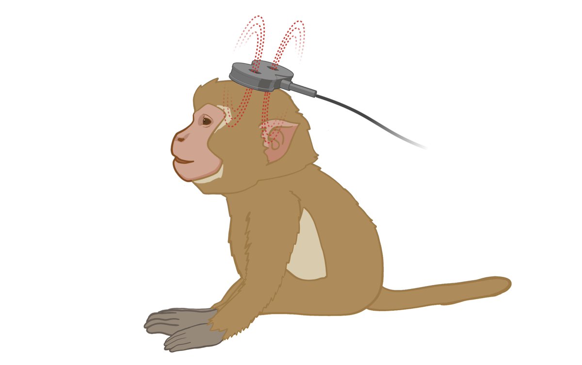 Chen et al. show that bilateral theta burst stimulation enhances recovery in a non-human primate model of ischaemic stroke. The intervention improved upper limb function and promoted white matter repair, supporting its potential for stroke rehabilitation. shorturl.at/tdqFr