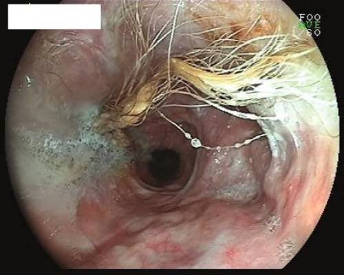 Keith Siau tweet media