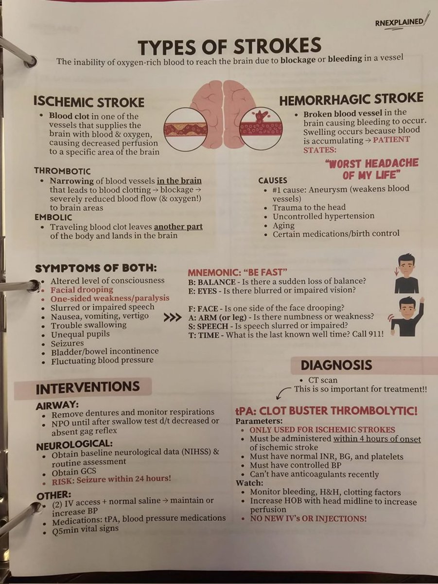 Stroke Summary