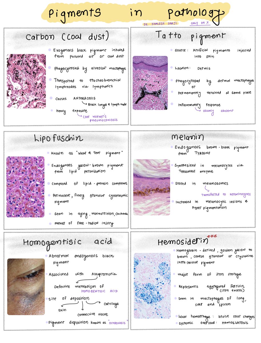 DrKamleshDarji1's tweet photo. Pigments in pathology #PathX #MedTwitter https://t.co/OKa2jhxNZy