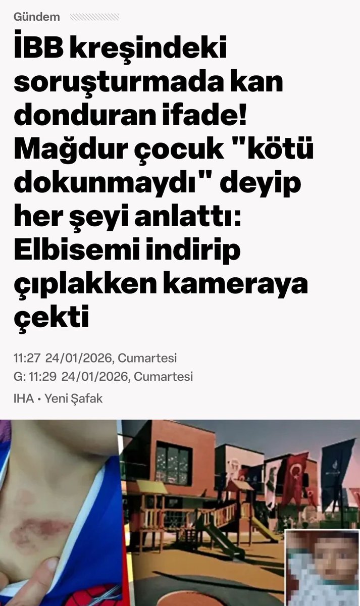 Şimdi elinizi vicdanınıza koyun söyleyin: Bu olay İBB kreşinde değil de, Ak Parti belediyesi yahut muhafazakar kurumda olsa ne olurdu? Muhalif tayfa, sanat sepet tayfa ne yapardı? Hiç ses çıktığını gördünüz mü?