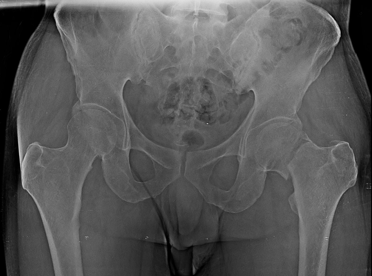 anconeus tweet media