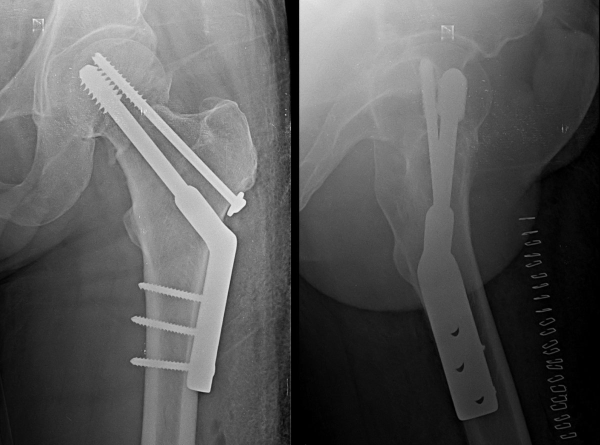 anconeus tweet media