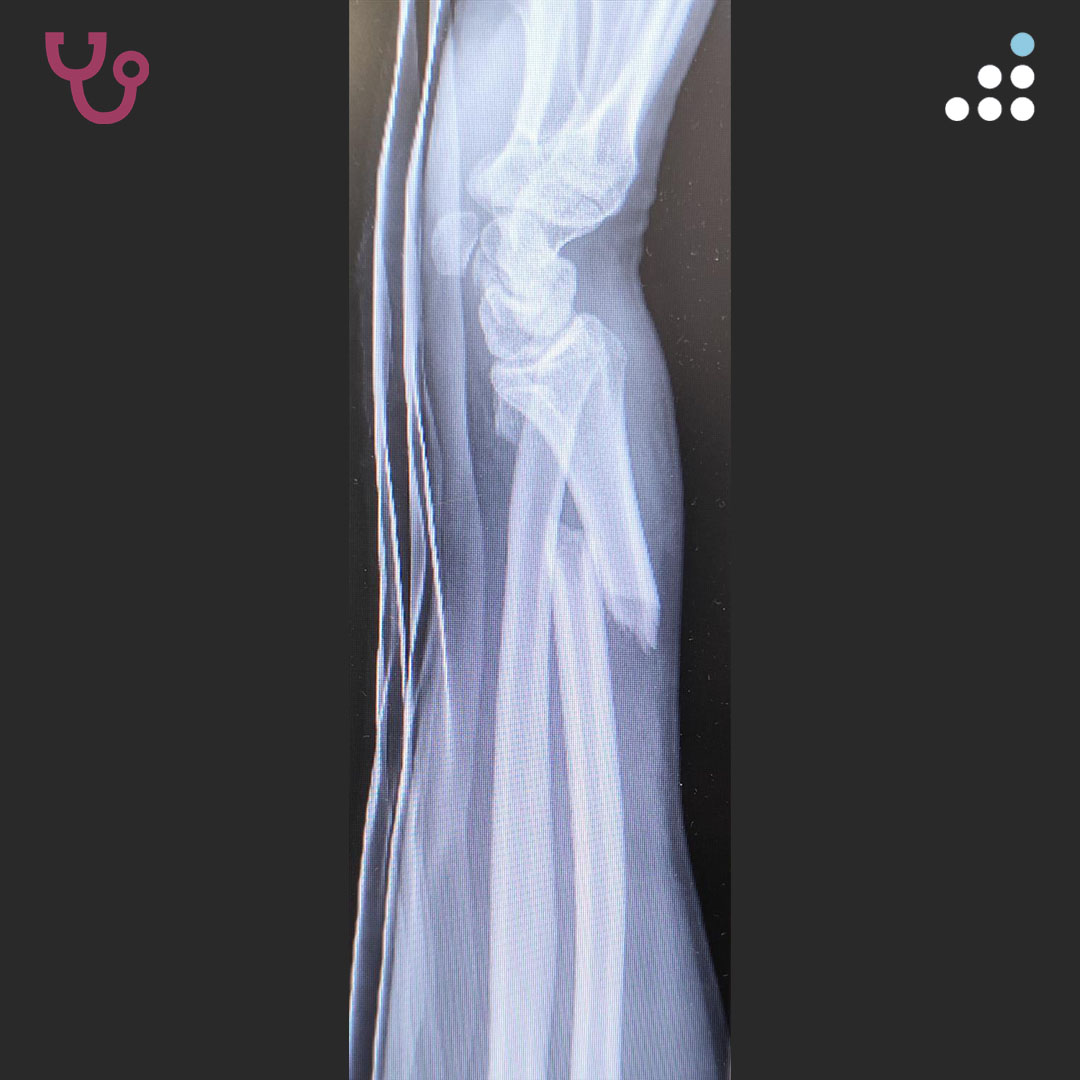 Orthobullets tweet media