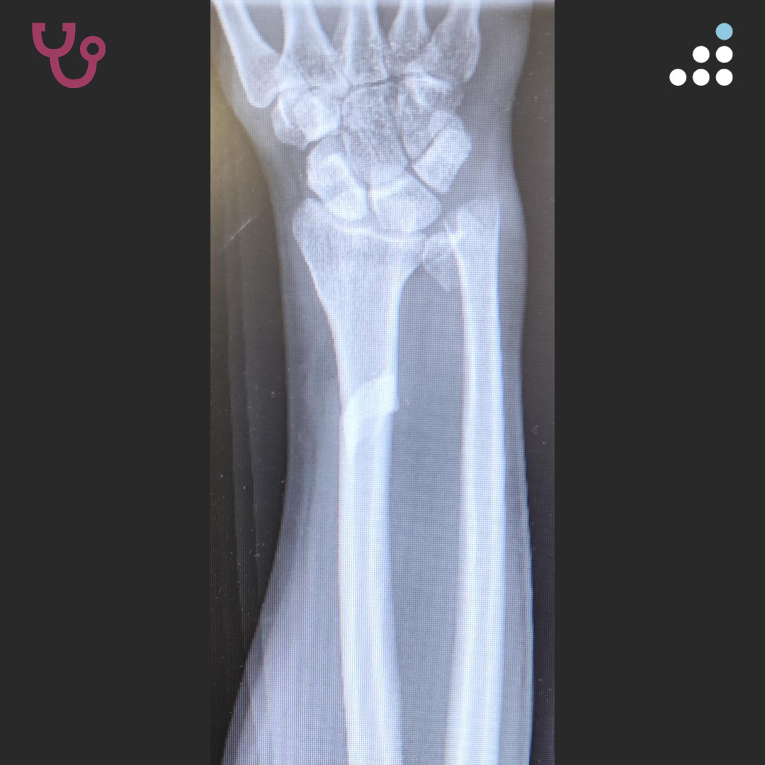 Orthobullets tweet media