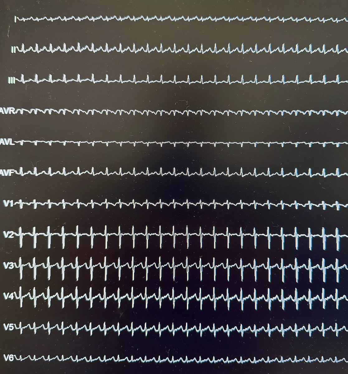 Rodrigo Isa Param tweet media