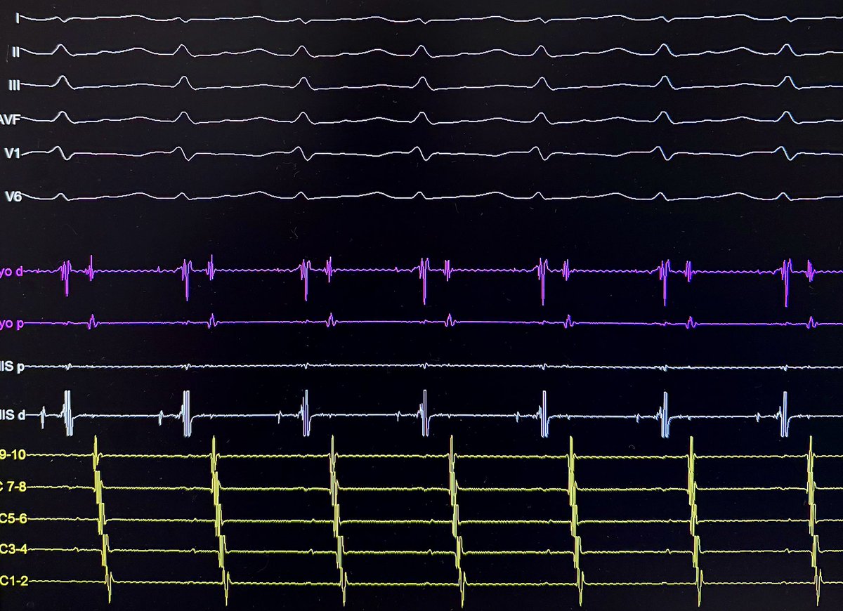 Rodrigo Isa Param tweet media