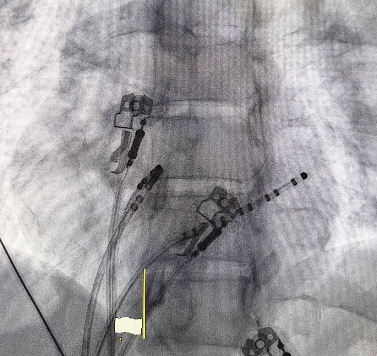 Rodrigo Isa Param tweet media