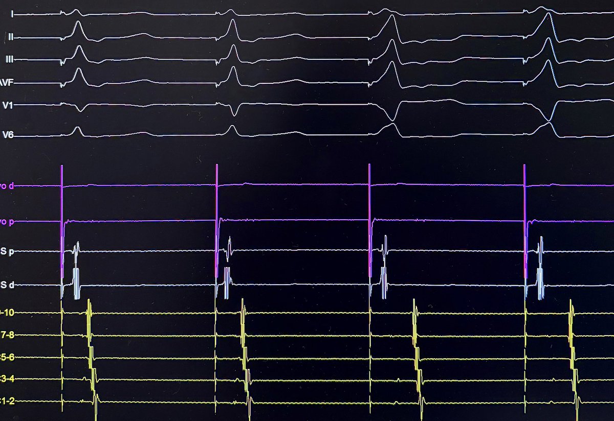 Rodrigo Isa Param tweet media