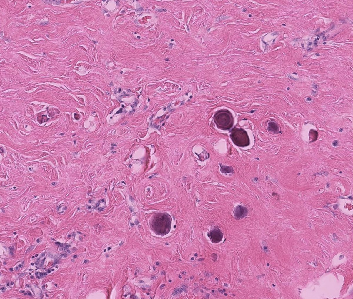 Toby Schmitt, MD tweet media