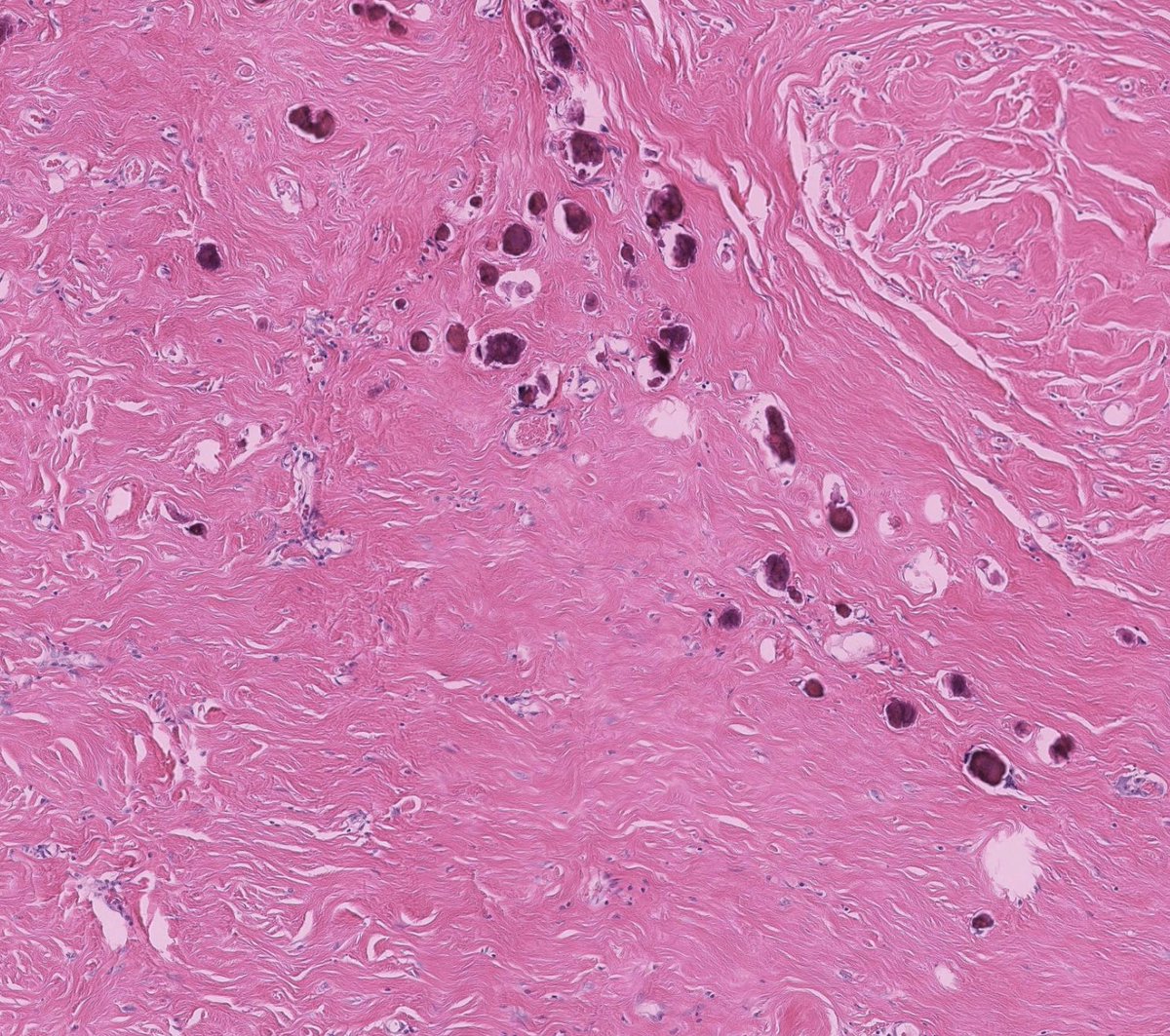 Toby Schmitt, MD tweet media