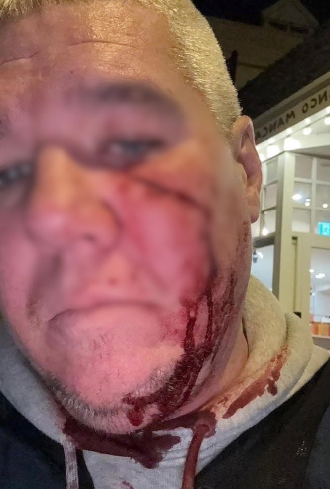 Away.Ends tweet media