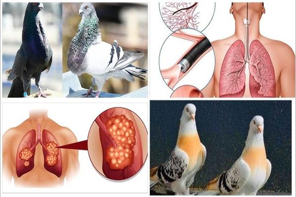 الخطر الصامت.. مرض يصيب الرئة بسبب الطيور المنزلية.. اعرف طرق الوقاية 