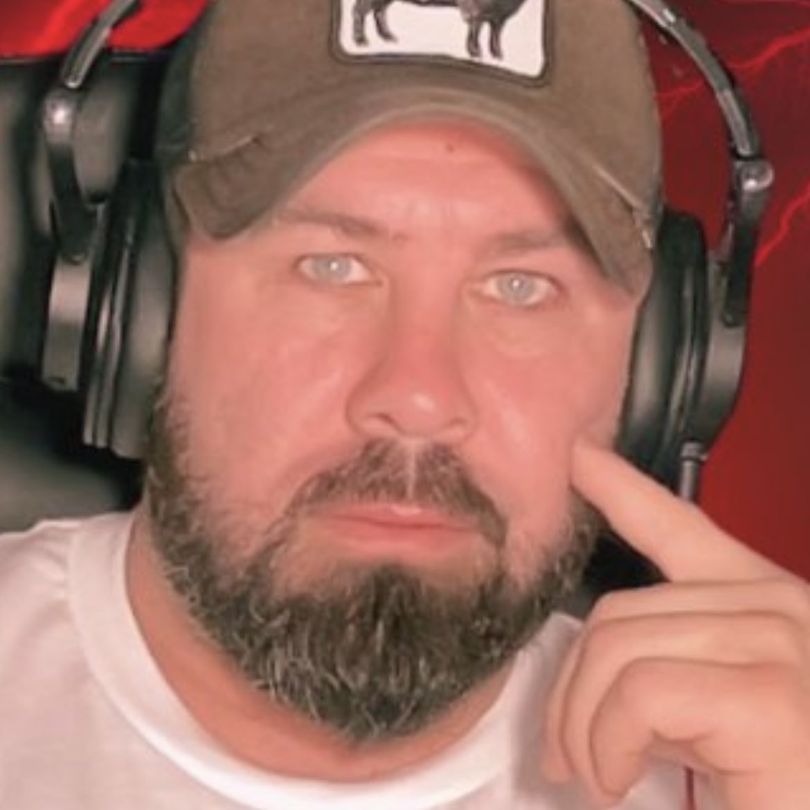 wrotator's tweet image. Hi fat! Your eyes are too small and too close to each other (short palpebral fissures and intercanthal distance). This dysmorphic feature, in conjunction with your evident cognitive issues, paints a troubling picture—I would’ve advised you to have a long, difficult conversation…