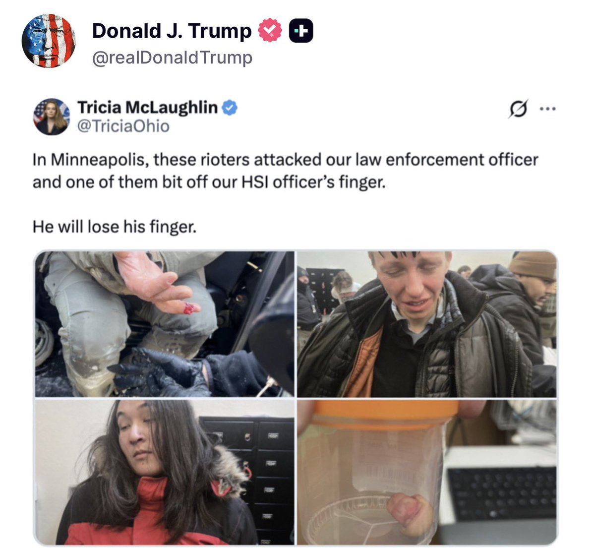 🚨 JUST NOW: President Trump confirms the leftist animals bit off the FINGER of a Homeland Security officer in Minneapolis

“He will lose his finger.”

These people are savages. Send them to CECOT.