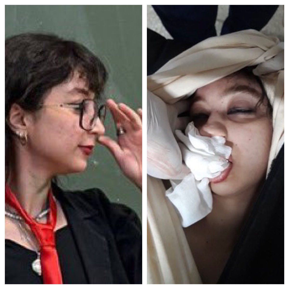 A human being, before and after the struggle for freedom in Iran.

The result of an implicit deal by the West, including the European Union, with the leaders of the Islamic Regime, including Khamenei, is the bodies of defenceless young protesters whose only expectation was a