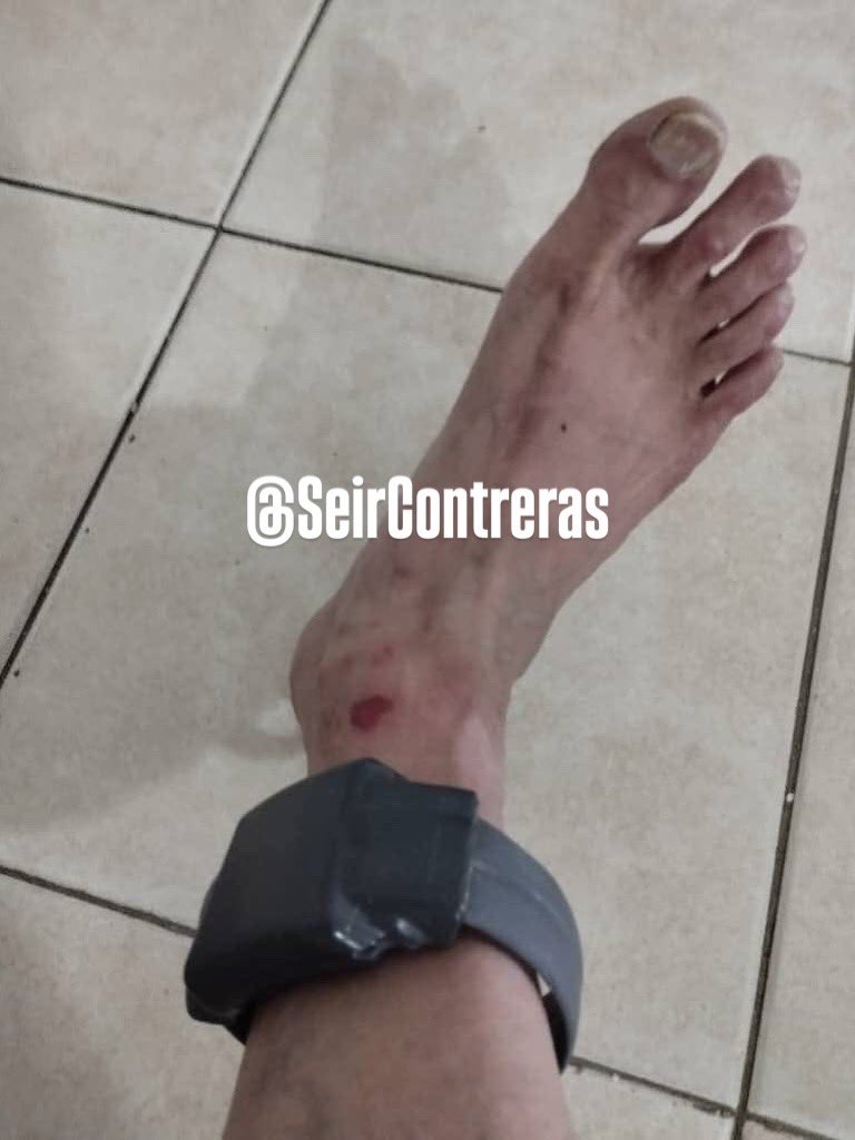 SeirContreras's tweet photo. Se conocen condiciones de reclusión del alcalde de El Tigre, Ernesto Paraqueima.

Fotos de 2026. Los familiares denuncian que, Paraqueima, “se encuentra confinado en una vivienda antigua con niveles críticos de humedad y moho, propiedad del SEBIN, en La Castellana, Caracas”. https://t.co/ezOZw8VJOE