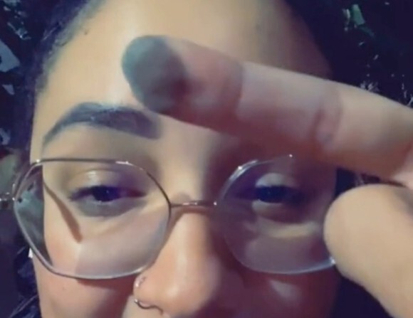 【いま読まれています】
ビキニラインから指へ皮膚移植した女性、指からアンダーヘアが生えてきたことを報告（アメリカ）
karapaia.com/archives/52299…