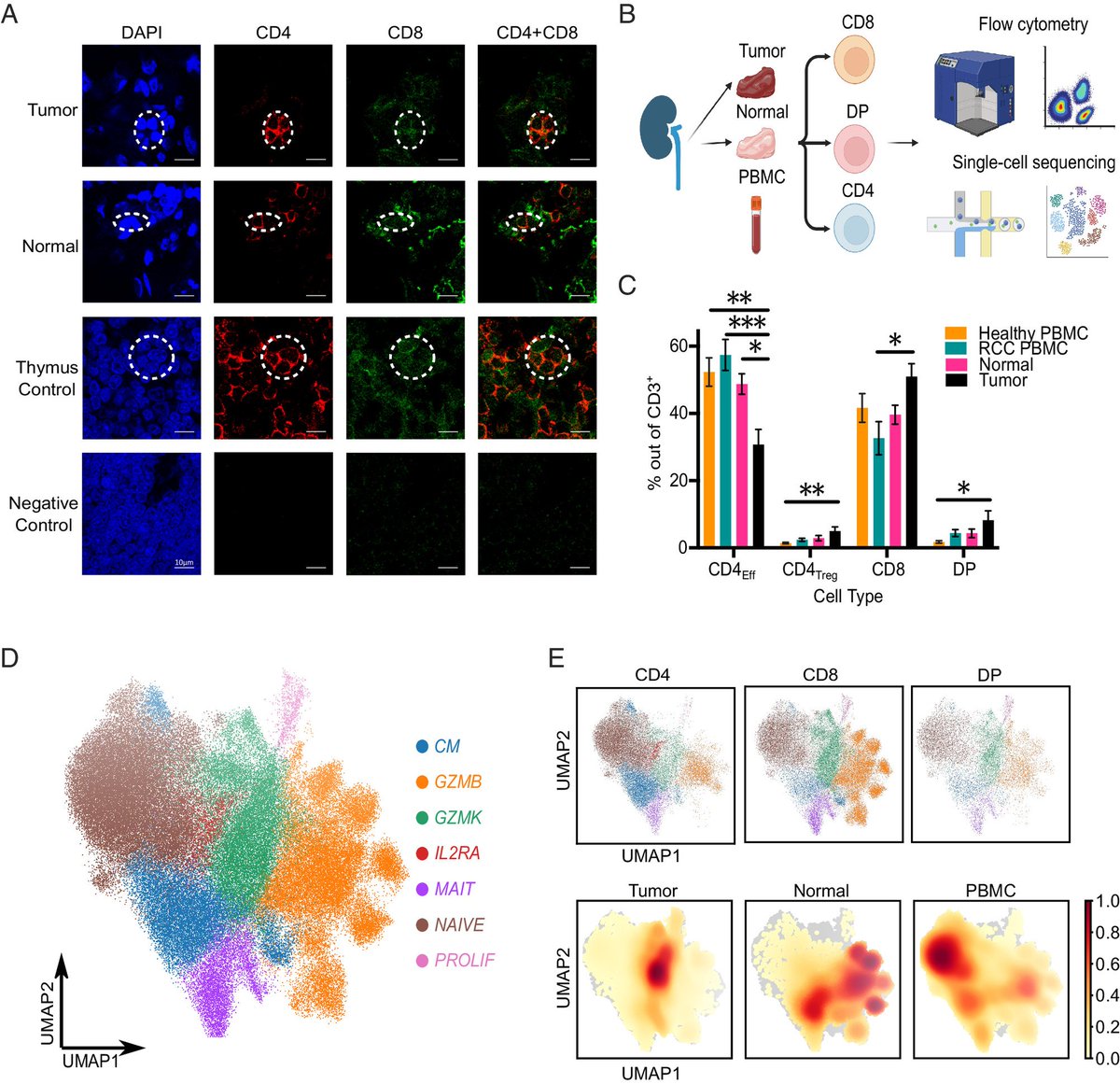 LabWaggoner's tweet photo. Intratumoral CD4+CD8+ T cells can serve as precursors to single positive T cells in vivo via Rag2 expression, suggesting that tumors act as extrathymic sites of T cell development @UCSF 
https://t.co/9GKYUKkcFa https://t.co/qS4Vfa1jYz