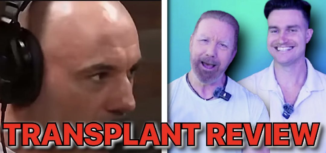 BobbyD__83's tweet image. Reacting to Joe Rogan’s hair transplant talk with National Hair Consultant Steve Michaels 👇

What he said matters more than you think if you’re considering hair restoration.

Watch the full reaction here: youtu.be/9LoZyQkuFCc?si…

#HairTransplant #HairLoss #JoeRogan