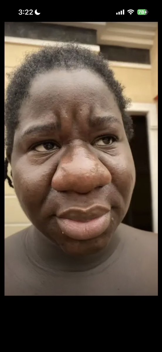 Lovelycoco83's tweet photo. @IbrahimaMa39342 @MarketOmega @ukhtinoodlez You look like this talking shit😂🤣🤣 https://t.co/3oHThPY9S5