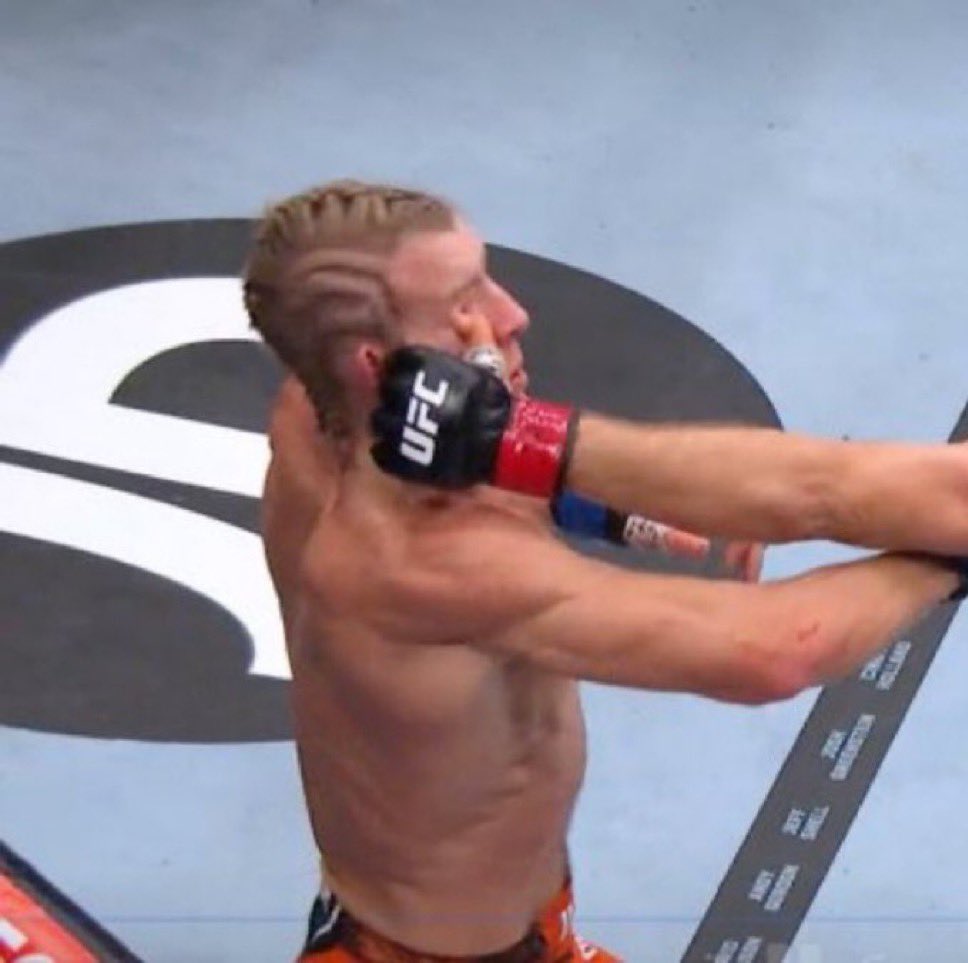 Finger poke compromises Paddy Pimblett’s eye before he knockdown

Heres the pic towards the end of the 2nd round #UFC324