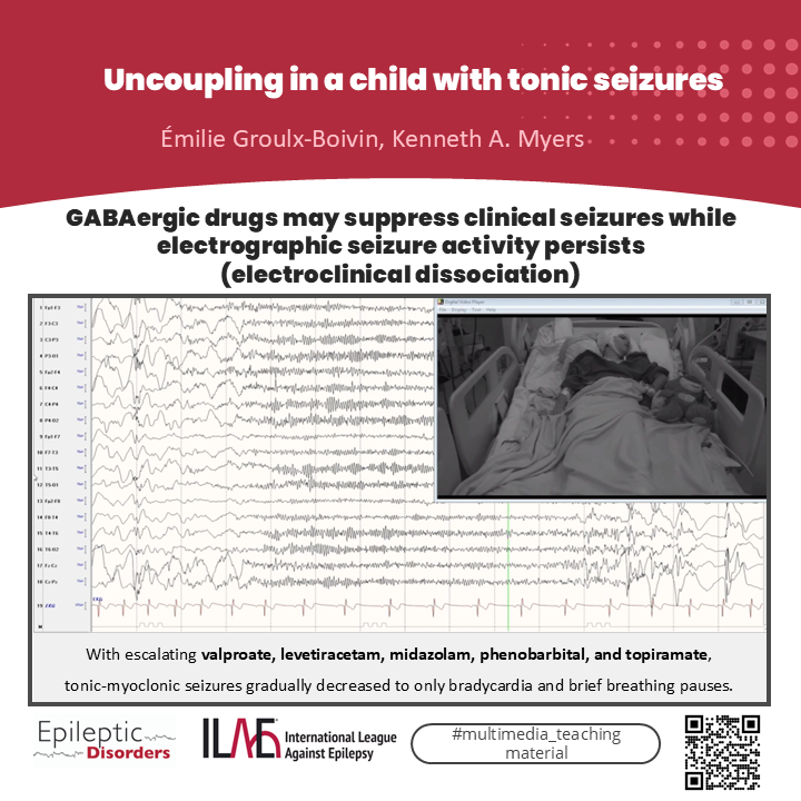 Epileptic Disorders tweet media