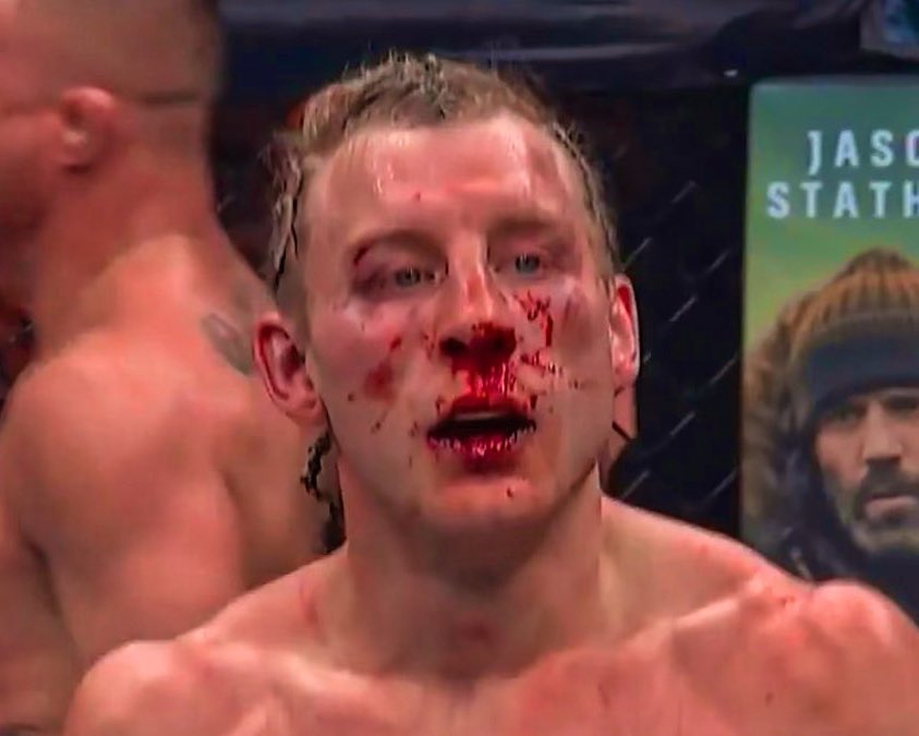 AndreSaintAlbin's tweet photo. PADDY HAS 9 LIVES THIS MATCH! BEST FIGHT OF THE NIGHT!  #UFC324 #UFC #UFC2026 #paddy #GaethjePimblett https://t.co/cdBLZ8ZLKn