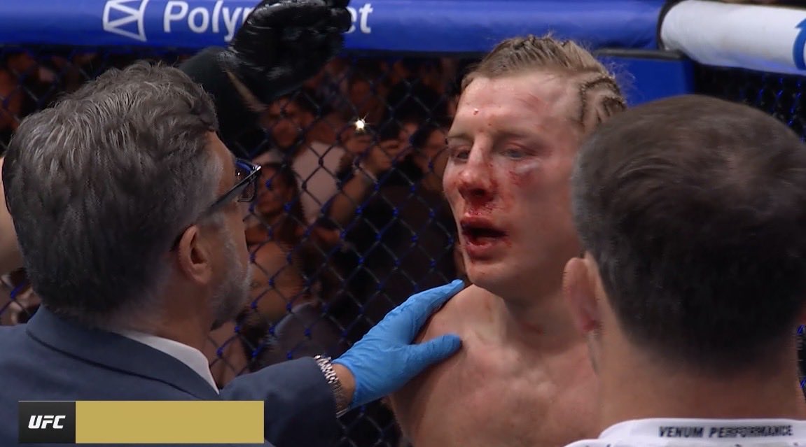 JohnnyWrrld tweet media