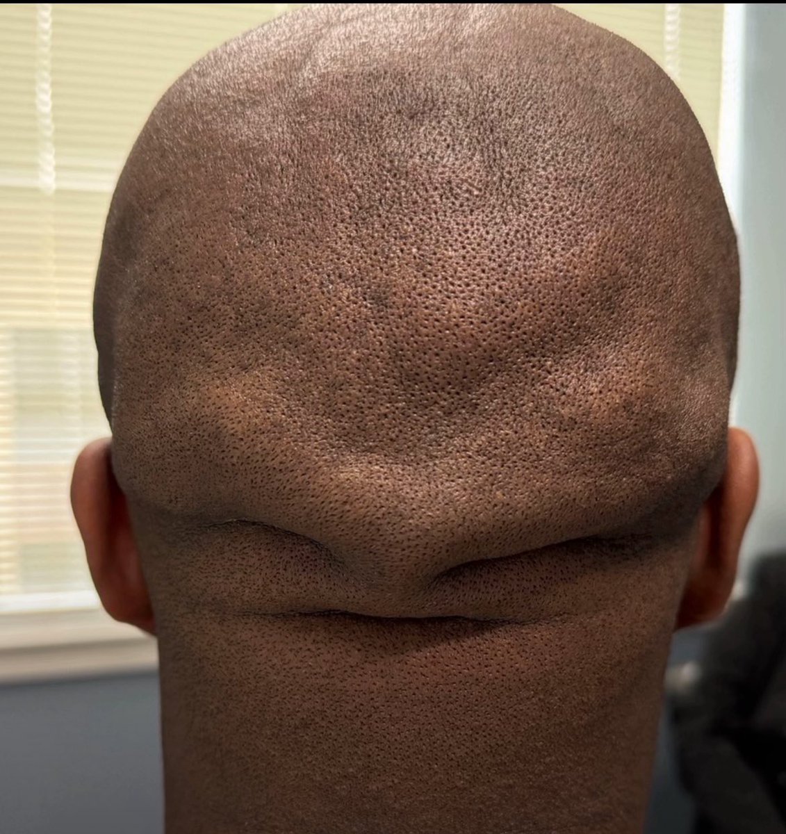 Isabelle002Anku's tweet image. Men’s heads when they reach 35👀😂😂