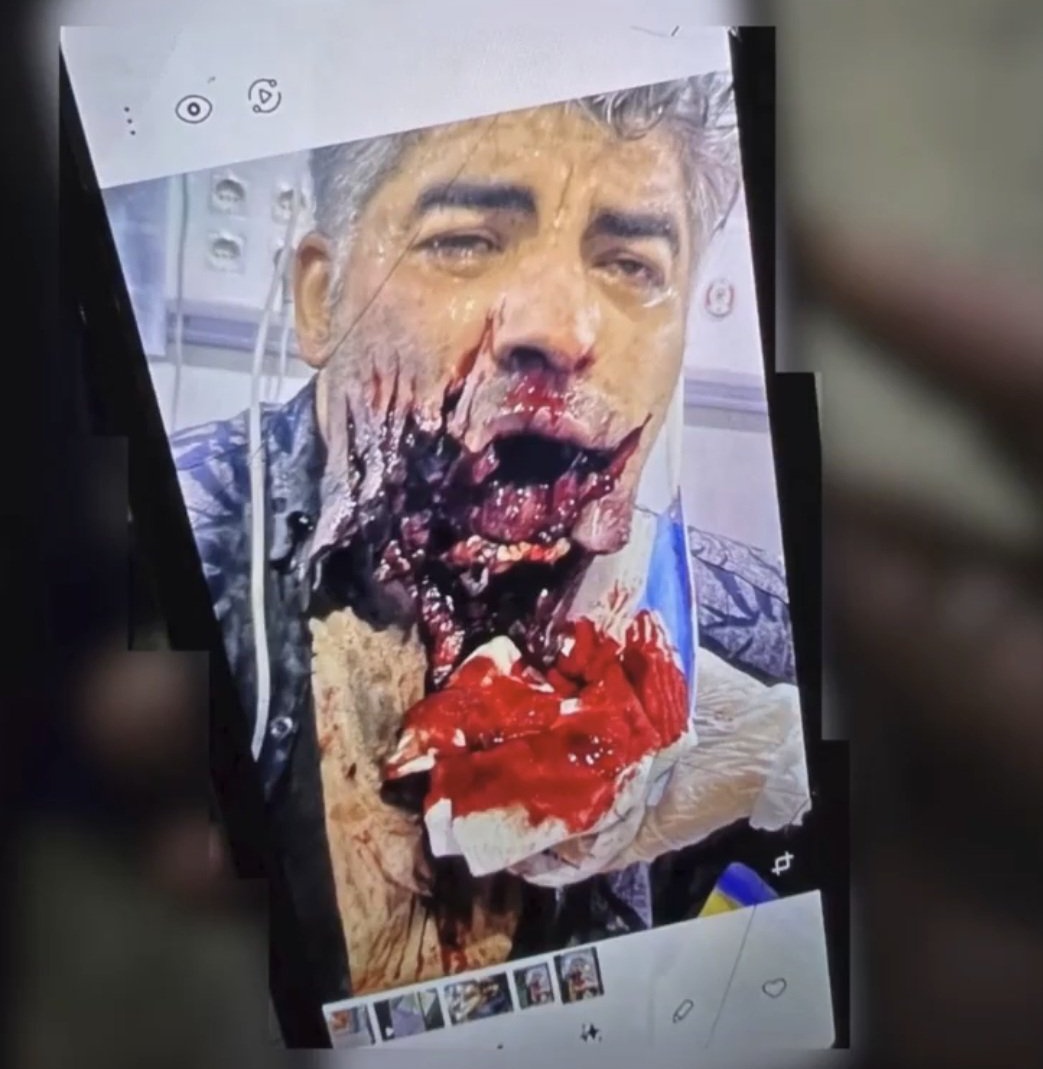 🇮🇷شیر و خورشید۲🥷 tweet media