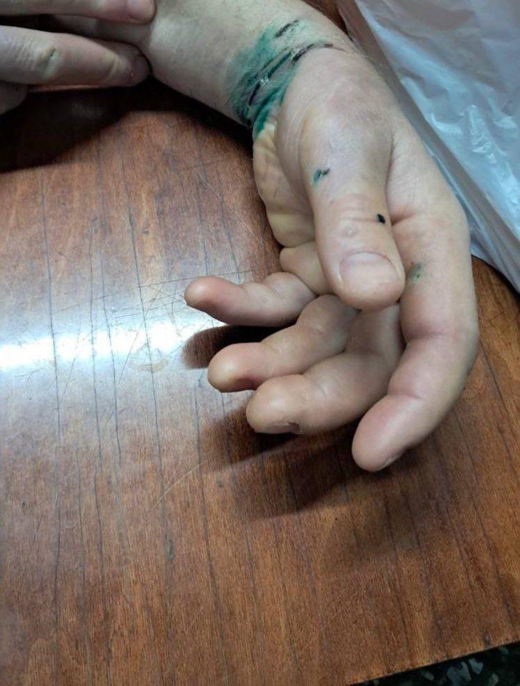 В Приморье новобранца Сергея Бодалева избили военные полицейские, заковали в наручники и отправили на фронт с переломами рёбер. 
Этот случай — не единичный. В крае регулярно сообщают об избиениях, принуждении к контрактам, вымогательстве и удержании в/служащих под замком