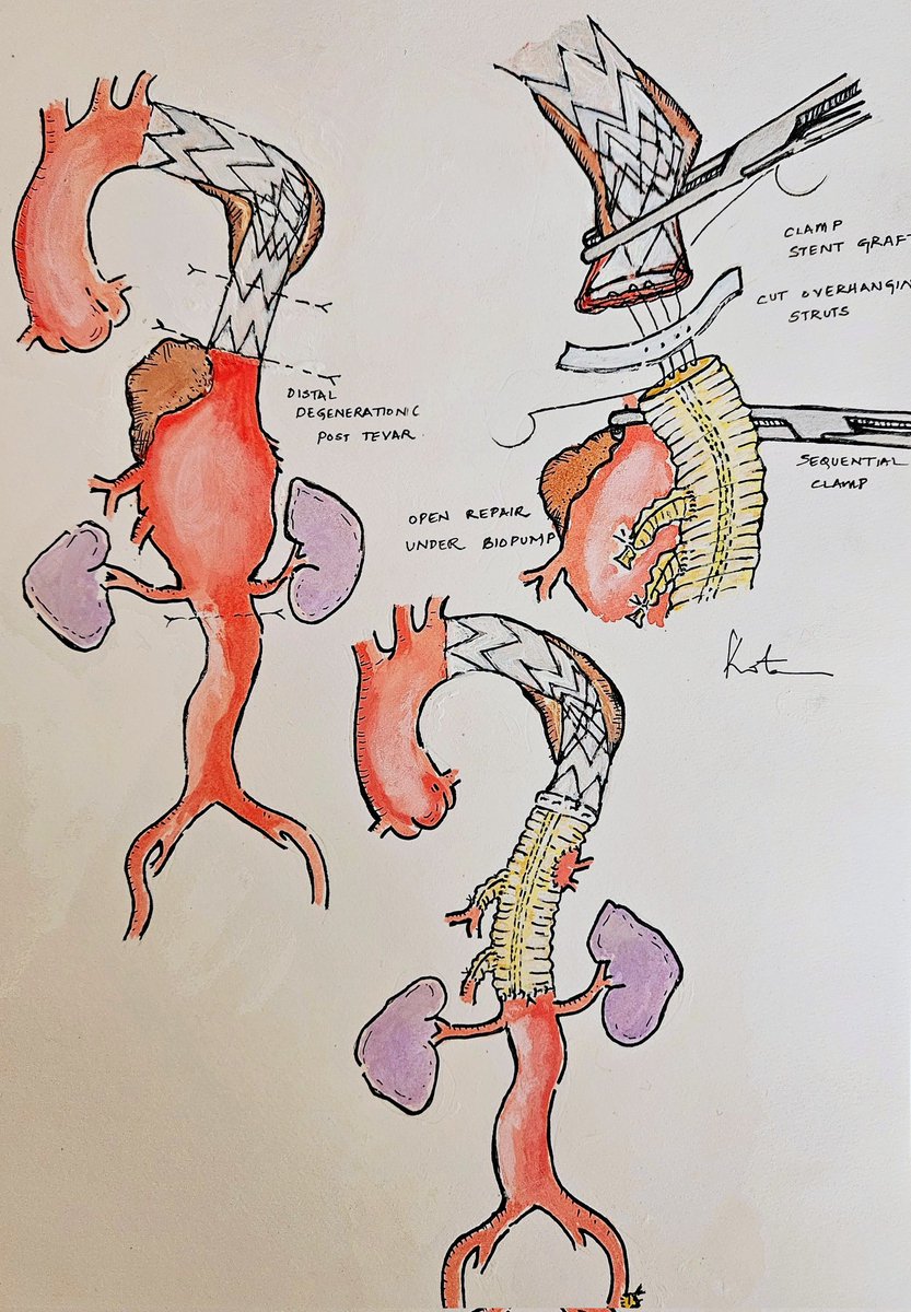 Prajna Kota MS, MCh tweet media