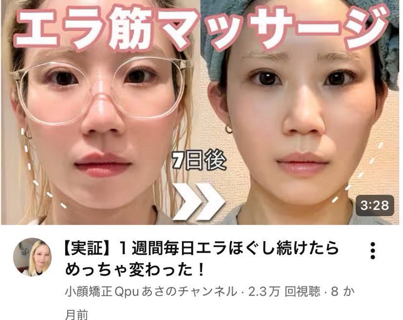 rara___chi's tweet photo. 顔ホームベース系女子へ⚾️
エラ無くしたいならこの２つ毎日朝やって‼️‼️ https://t.co/3CmsAVOig2