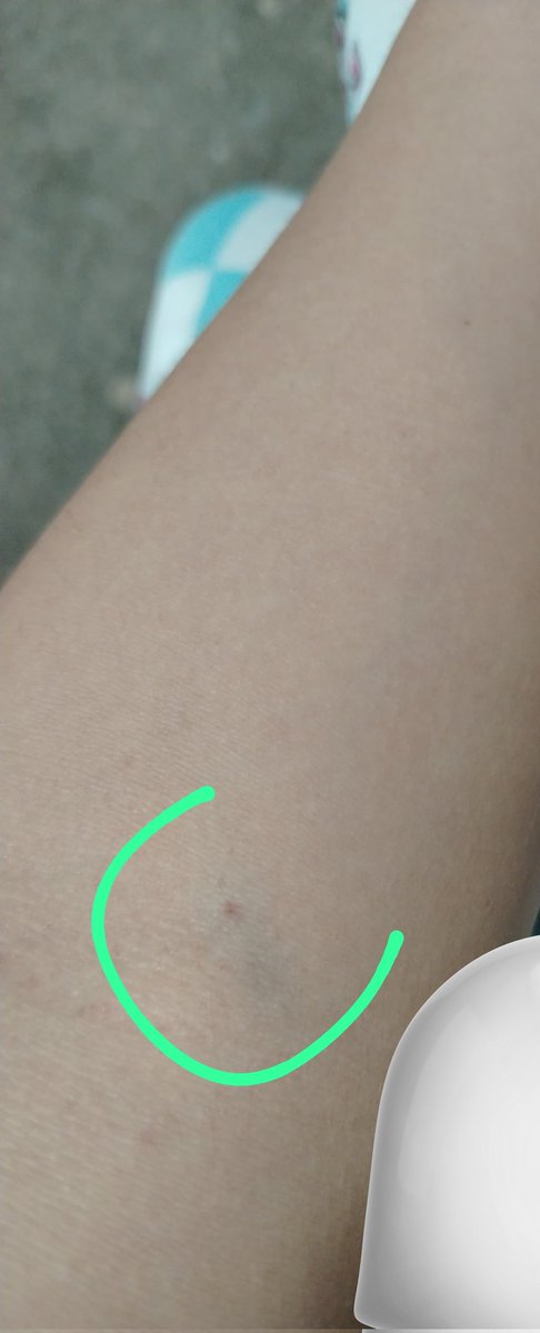 Tarde que temprano me voy a picar la venaa🤯🧊💉💉