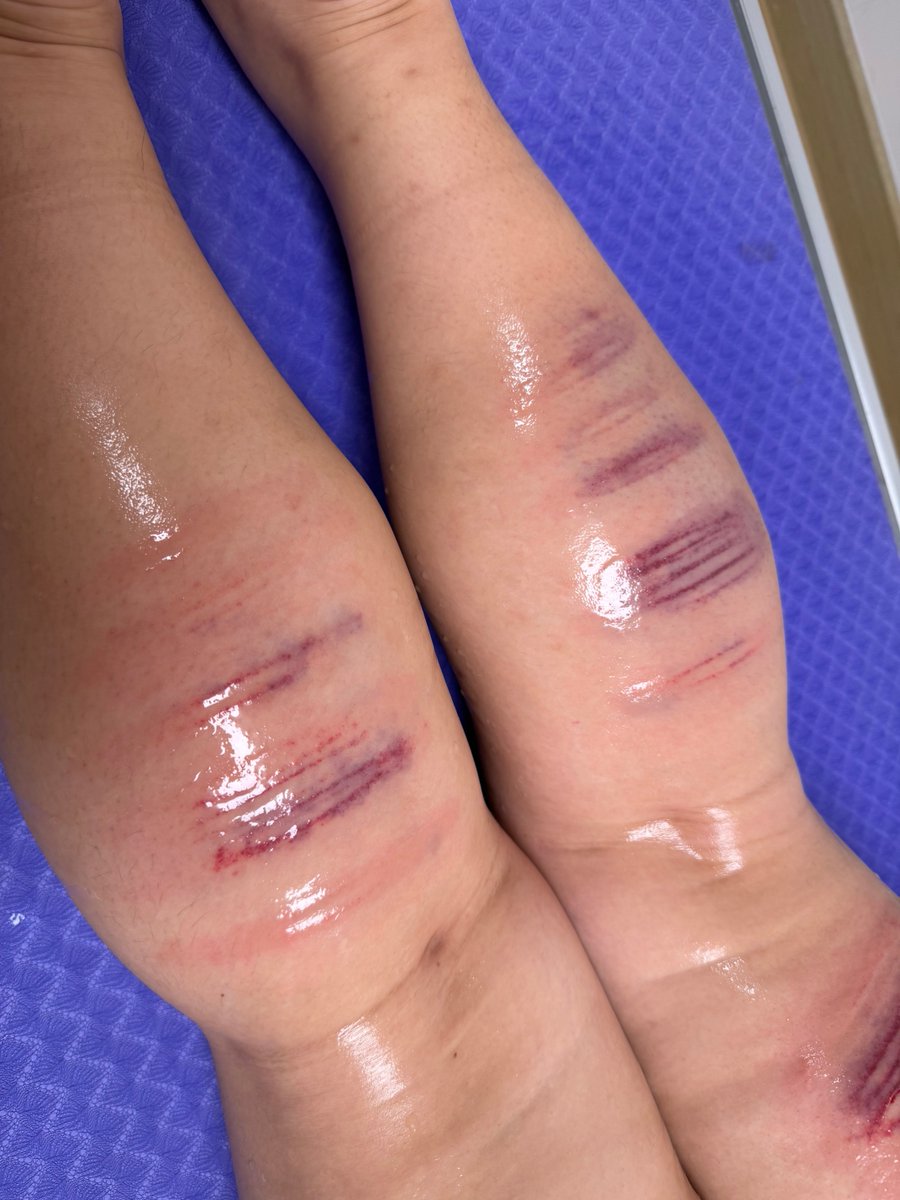 心狠手辣 tweet media