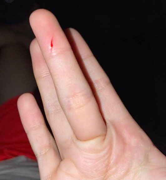 jungkovtae's tweet image. Pov: You accidentally touched Jungkook's jawline