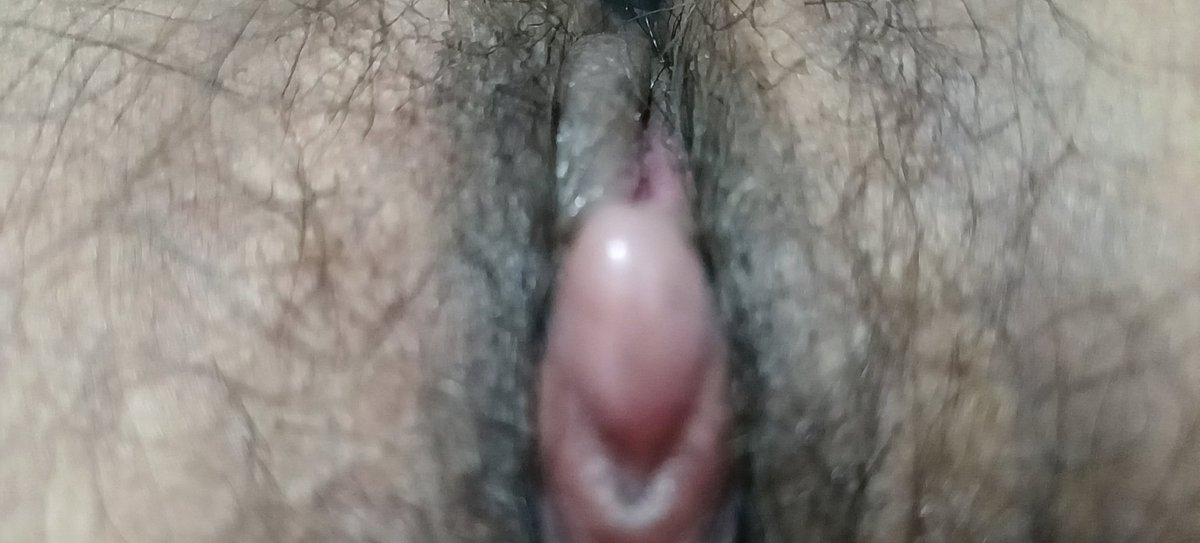 启明星 tweet media