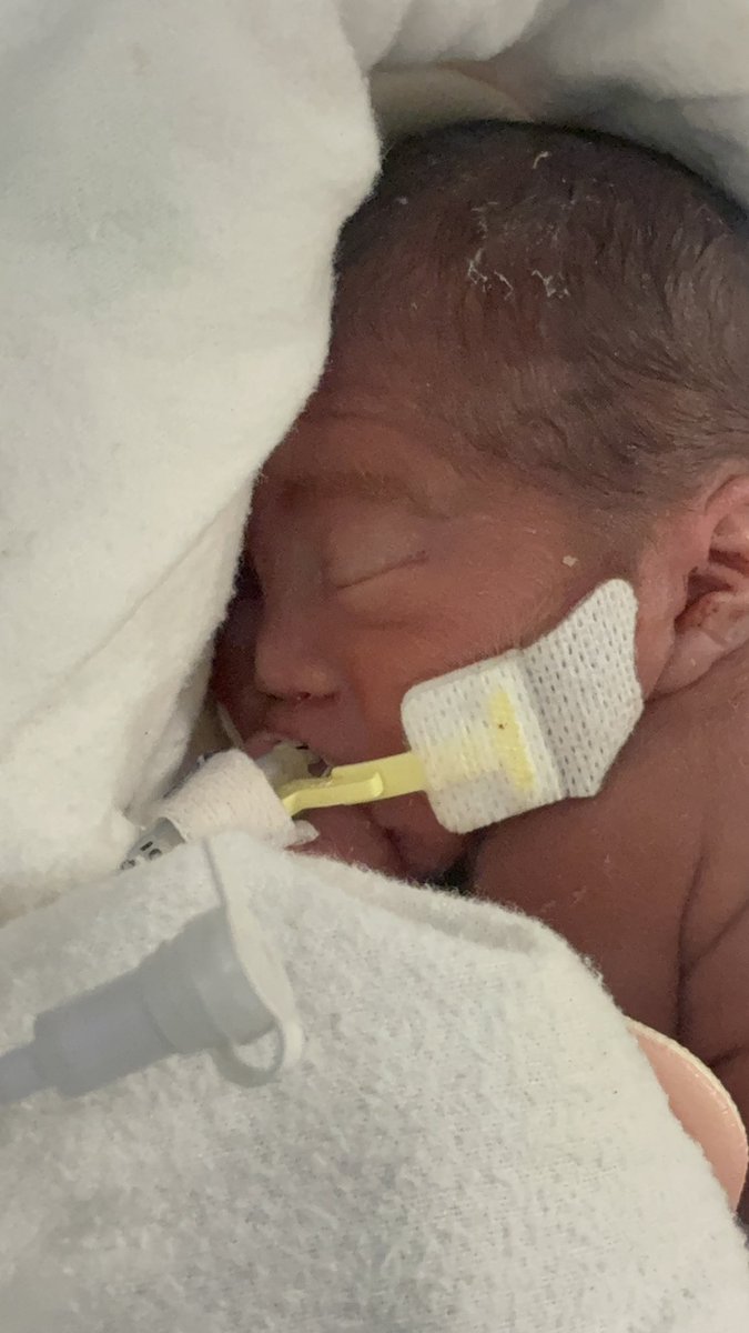 たま@超早産双子のパパ tweet media