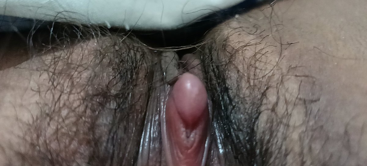 启明星 tweet media