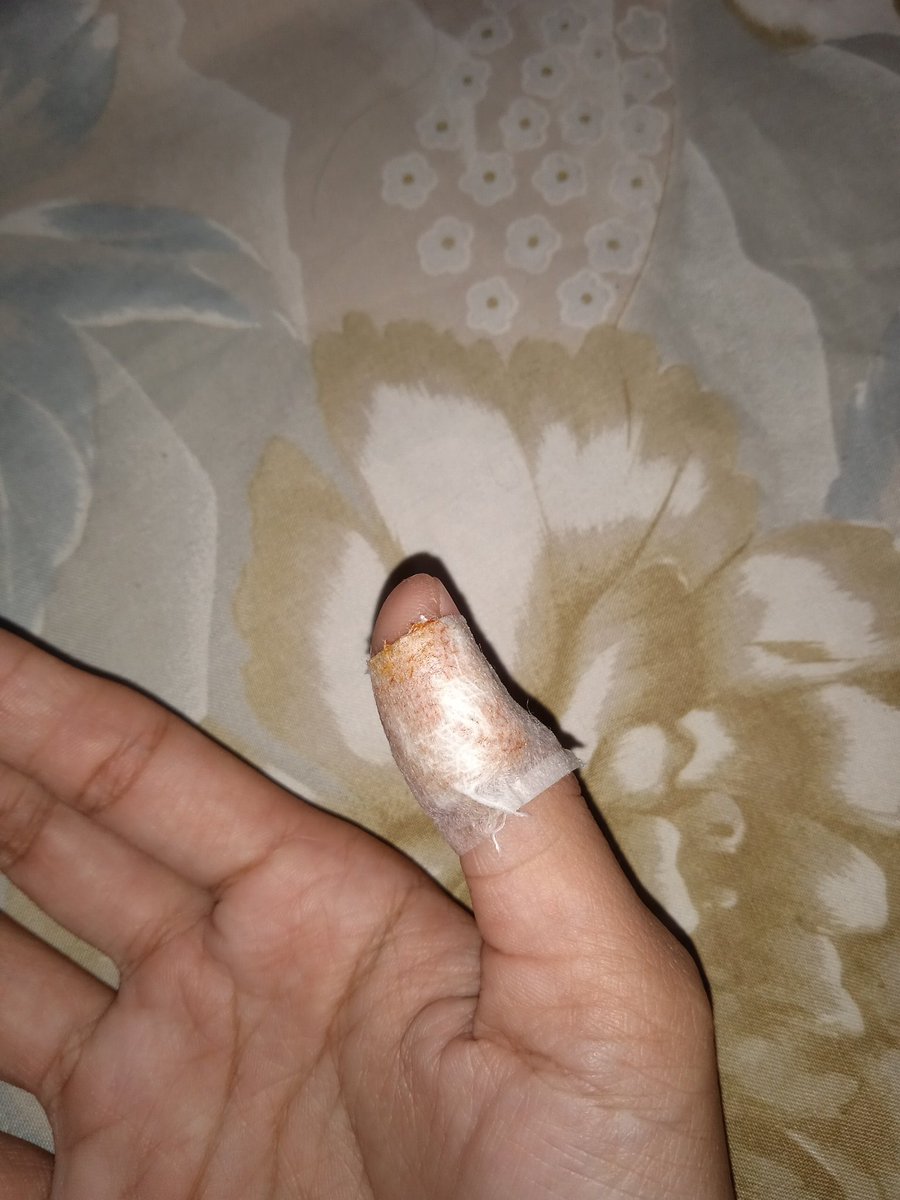 perkara lu ngupas salak doang, bener² lu litttttt kulitttttt